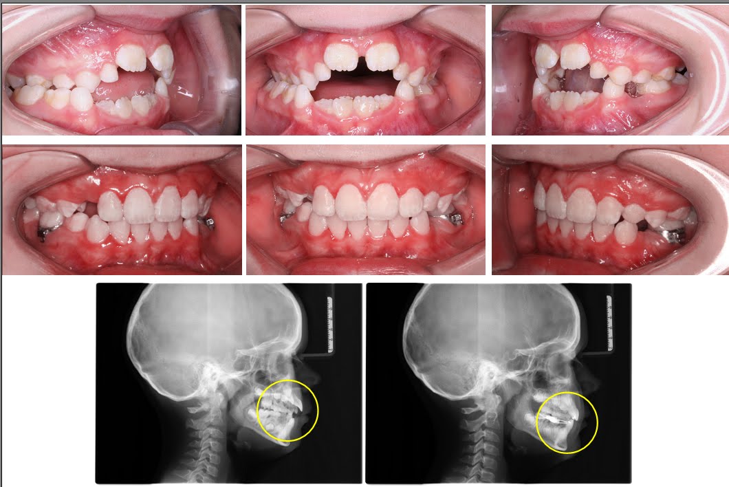 Cosmetic dental treatment