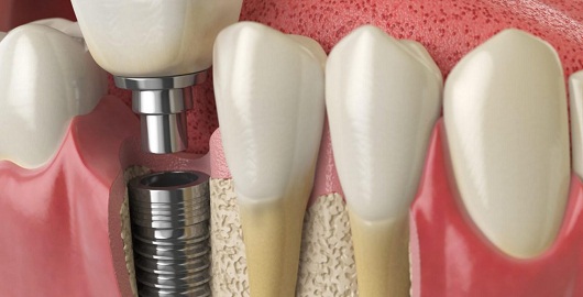 Best Dental Clinic