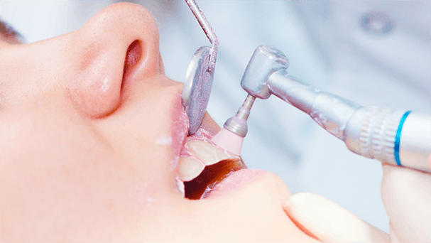 Teeth Cleaning Treatment