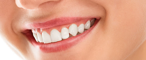 Smile Designing